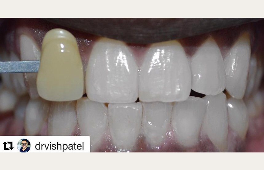 After - Brigstock Dental