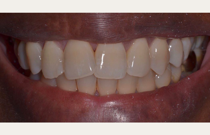 Before - Brigstock Dental