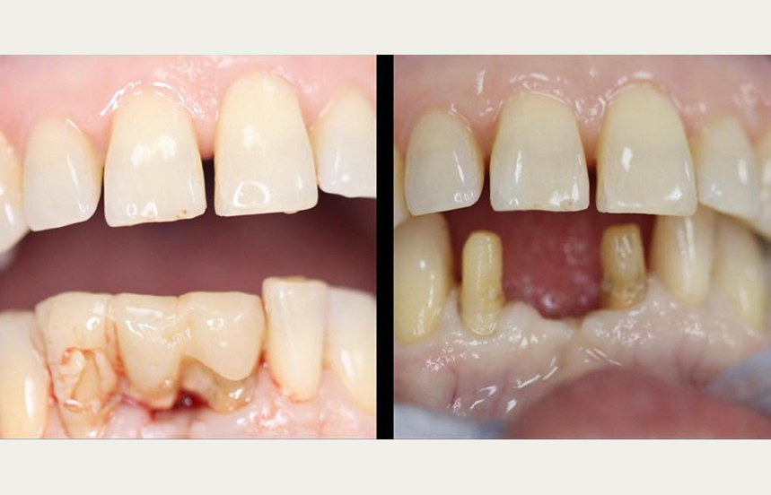 Before - Brigstock Dental