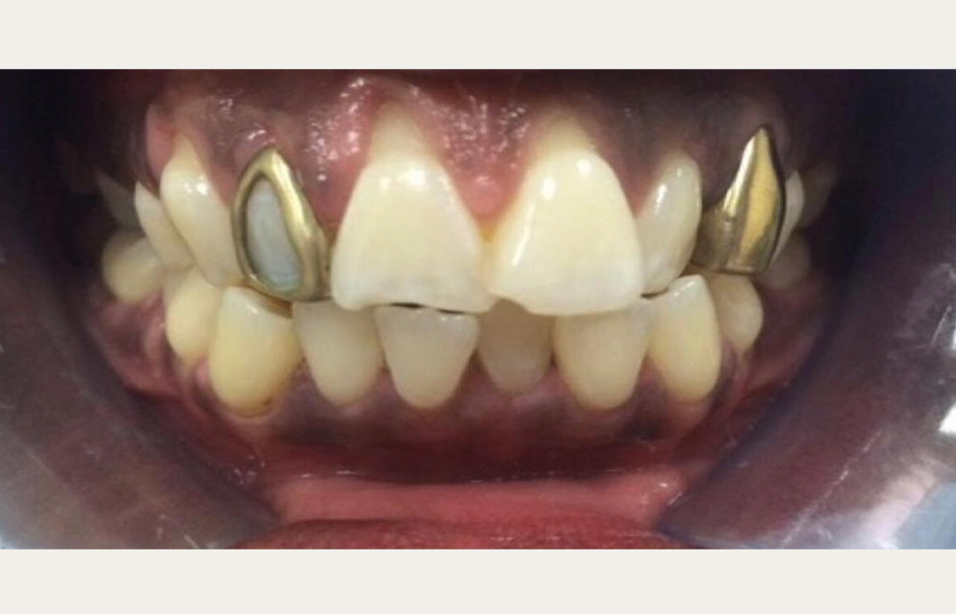 Before - Brigstock Dental