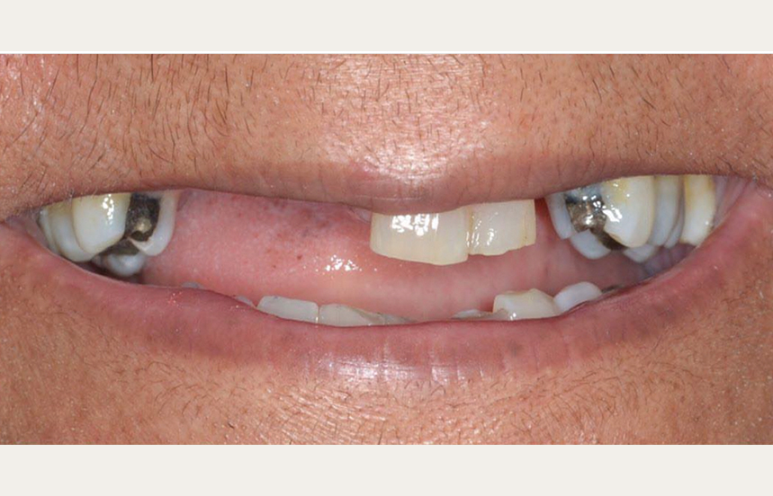 Before - Brigstock Dental