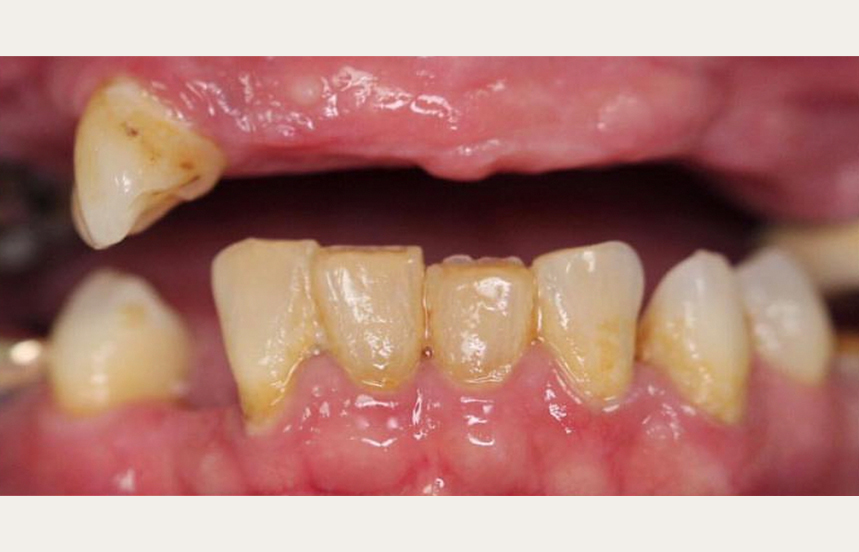 Before - Brigstock Dental