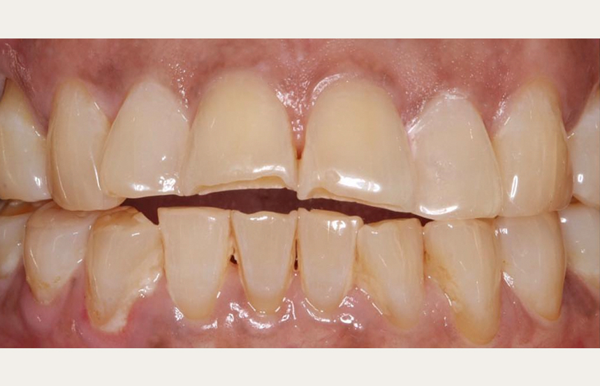 Before - Brigstock Dental