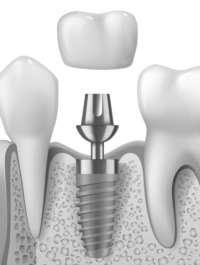 Treatment - Brigstock dental