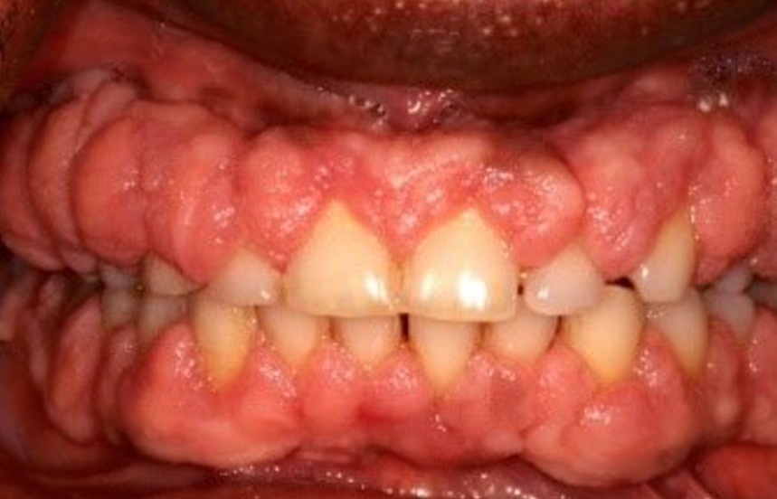 Before - Brigstock Dental