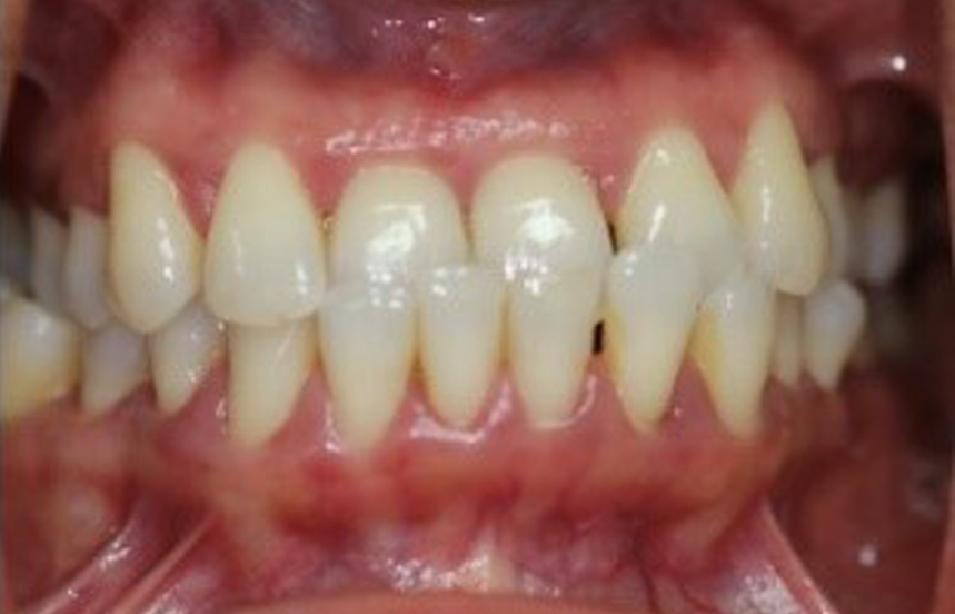 Before - Brigstock Dental