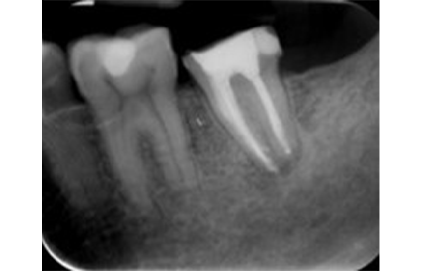 After - Brigstock Dental